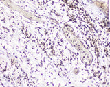Anti-UBE2I UBC9 Antibody Picoband® Boster Bio
