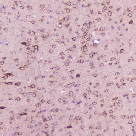 Anti-Calcitonin/Calca Antibody Boster Bio
