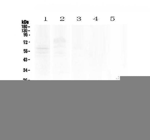 Anti-Psoriasin/S100A7 Antibody Picoband® Boster Bio