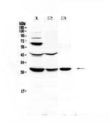 Anti-TL1A/TNFSF15 Antibody Picoband® Boster Bio