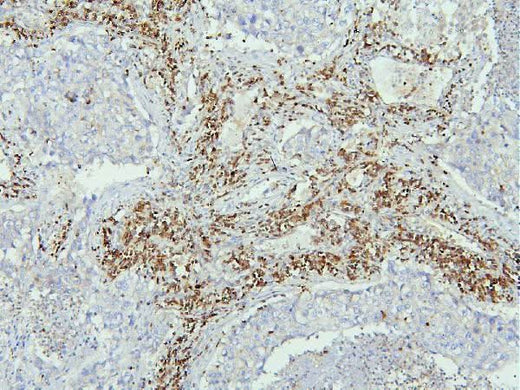 Anti-EBP50/NHERF-1/SLC9A3R1 Antibody Picoband® Boster Bio