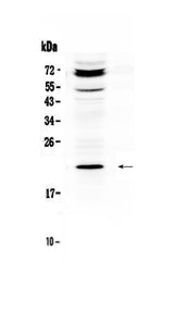 Anti-C19orf80/ANGPTL8 Antibody Picoband® Boster Bio