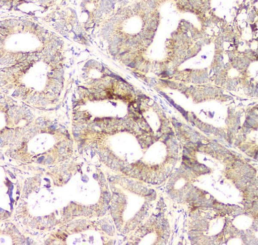 Anti-Aprt Antibody Picoband® Boster Bio