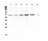 Anti-PIAS3 Antibody Picoband® Boster Bio