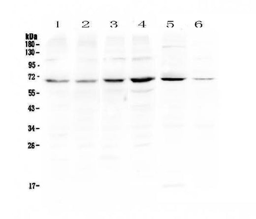 Anti-PIAS3 Antibody Picoband® Boster Bio