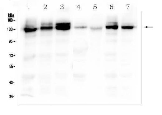 Anti-Integrin alpha 3/ITGA3 Antibody Picoband® Boster Bio