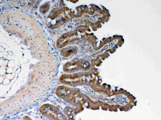 Anti-GALNS Antibody Picoband® Boster Bio