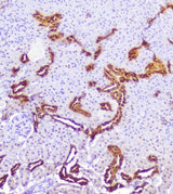 Anti-Calbindin/CALB1 Antibody Picoband® Boster Bio