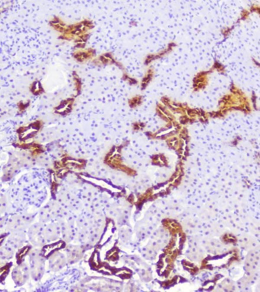 Anti-Calbindin/CALB1 Antibody Picoband® Boster Bio