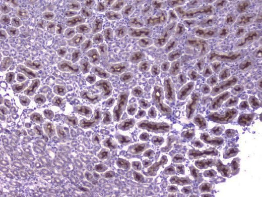 Anti-CCL8 Antibody Boster Bio