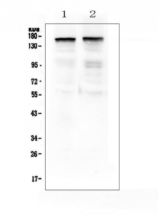 Anti-Thrombospondin 2/THBS2 Antibody Picoband® Boster Bio