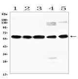 Anti-AVPR1A/V1aR Antibody Picoband® Boster Bio