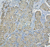 Anti-RPL13A Antibody Picoband® Boster Bio