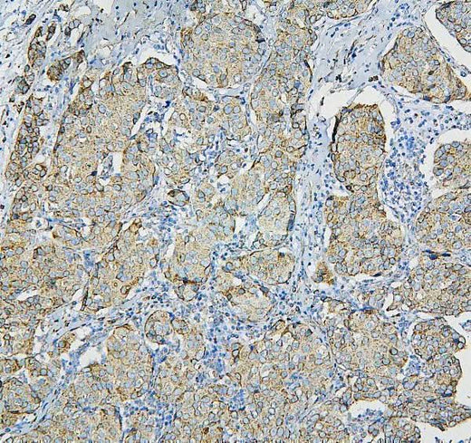 Anti-RPL13A Antibody Picoband® Boster Bio