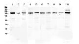 Anti-PCDH15 Antibody Picoband® Boster Bio
