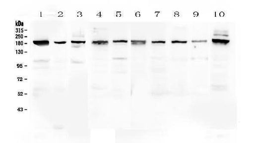 Anti-PCDH15 Antibody Picoband® Boster Bio