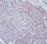 Anti-TRPV3 Antibody Picoband® Boster Bio