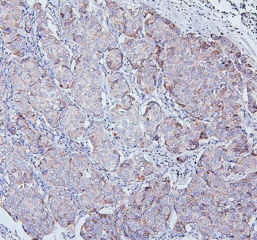 Anti-TRPV3 Antibody Picoband® Boster Bio