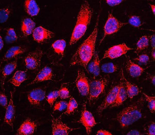 Anti-MTUS1 Antibody Picoband® Boster Bio
