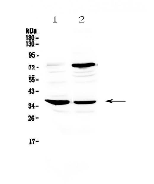 Anti-CD23/FCER2 Antibody Picoband® Boster Bio
