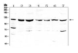 Anti-RNF31/HOIP Antibody Picoband® Boster Bio