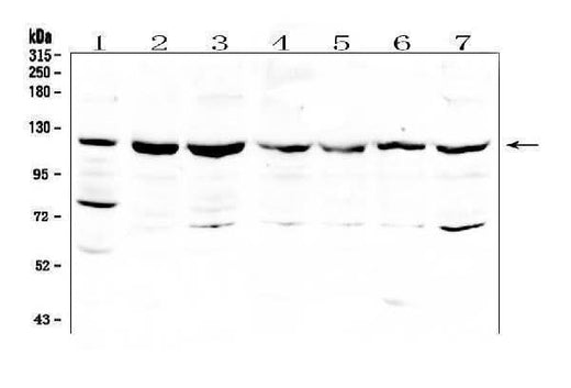 Anti-RNF31/HOIP Antibody Picoband® Boster Bio