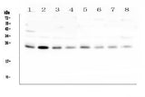 Anti-RAB11B Antibody Picoband® Boster Bio