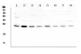 Anti-RAB11B Antibody Picoband® Boster Bio