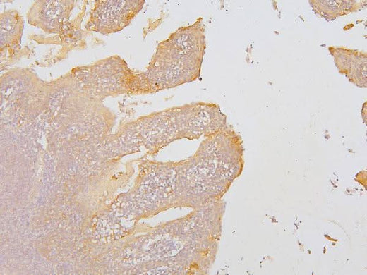 Anti-KCC2/SLC12A5 Antibody Picoband® Boster Bio