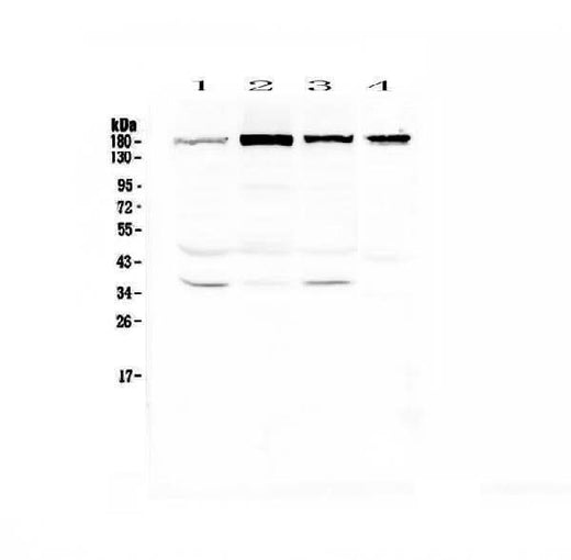 Anti-IQGAP2 Antibody Picoband® Boster Bio