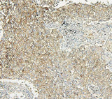 Anti-Aldolase/ALDOA Antibody Picoband® Boster Bio