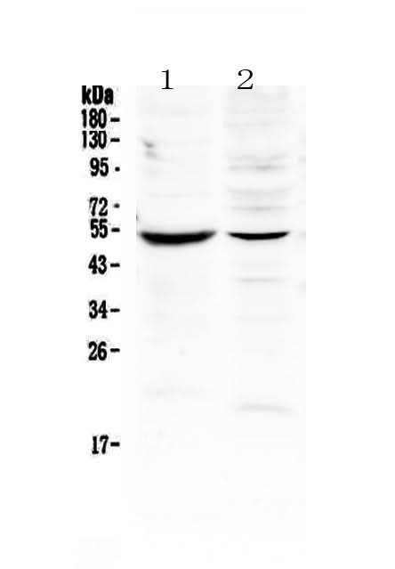 Anti-MMP16 Antibody Picoband® Boster Bio