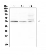 Anti-D6/ACKR2 Antibody Picoband® Boster Bio