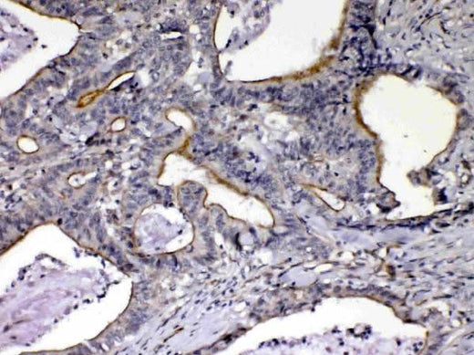 Anti-NOV/CCN3 Antibody Picoband® Boster Bio