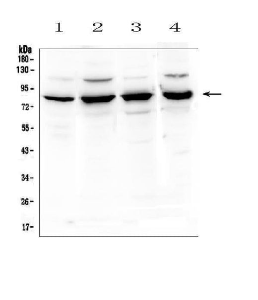 Anti-Semaphorin 3B/SEMA3B Antibody Picoband® Boster Bio