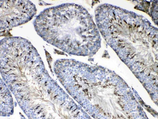 Anti-FMN1 Antibody Picoband® Boster Bio