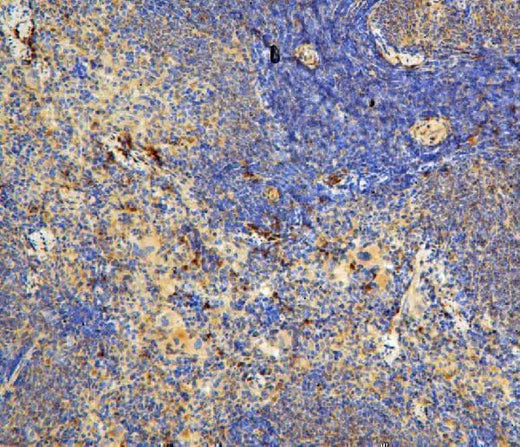 Anti-IL-31 Antibody Picoband® Boster Bio