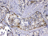 Anti-HOMER3 Antibody Picoband® Boster Bio