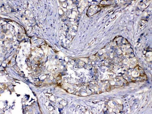 Anti-HOMER3 Antibody Picoband® Boster Bio