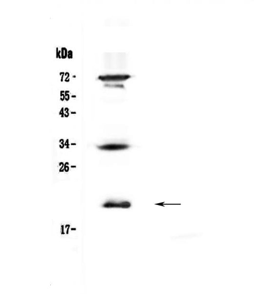 Anti-IL17B Antibody Picoband® Boster Bio
