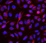 Anti-RBMS3 Antibody Picoband® Boster Bio