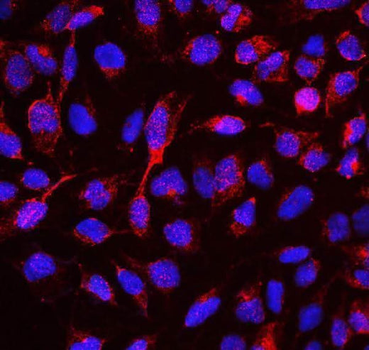 Anti-RBMS3 Antibody Picoband® Boster Bio