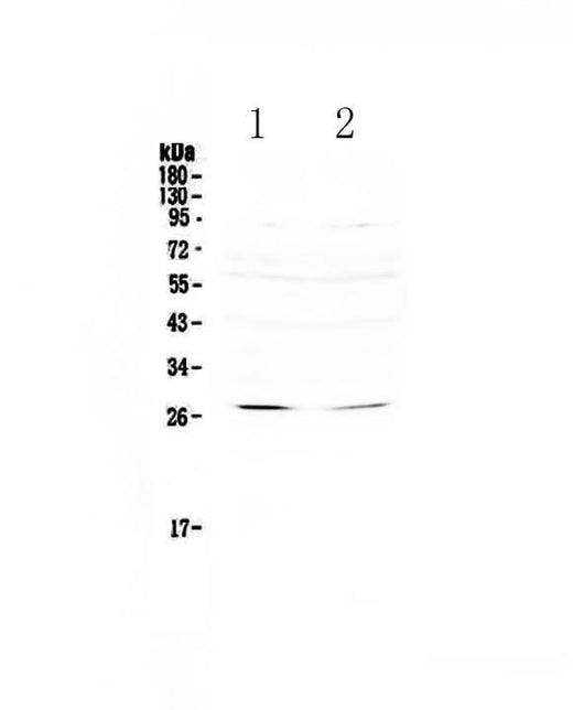 Anti-RNF186 Antibody Picoband® Boster Bio