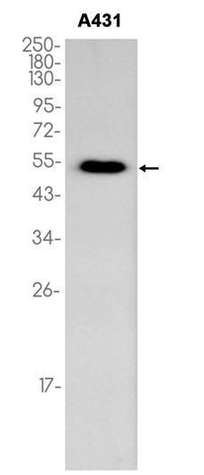 p53 western blot of human A431 cell extracts, antibody 1:1000
