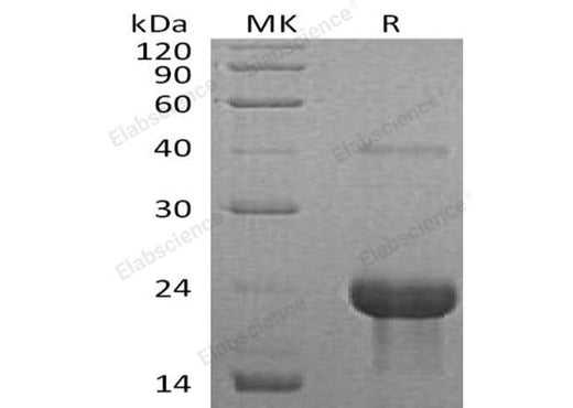 > 96 % as determined by reducing SDS-PAGE.