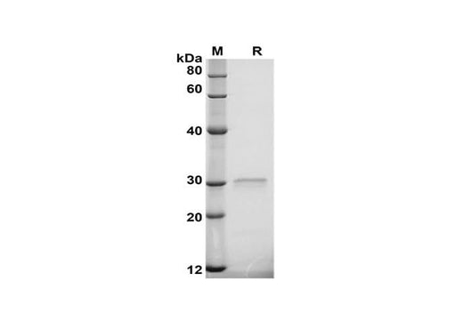 SDS-PAGE analysis of Porcine OPN/Osteopontin proteins, 2 μg/lane of Recombinant Porcine OPN/Osteopontin proteins was resolved with SDS-PAGE under reducing conditions, showing bands at 30 kDa.
