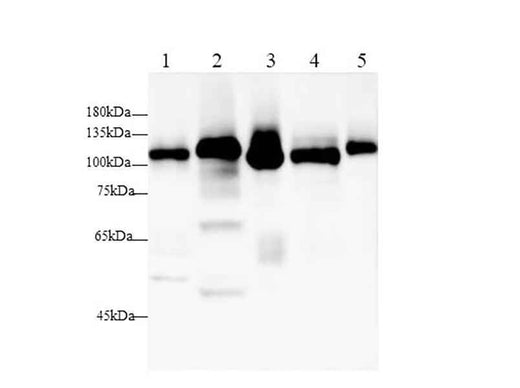 Anti-Mouse/Rat DPP4/CD26 Antibody - ABMIUM