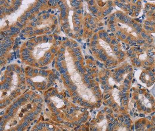 Anti-Human TLR8 Antibody