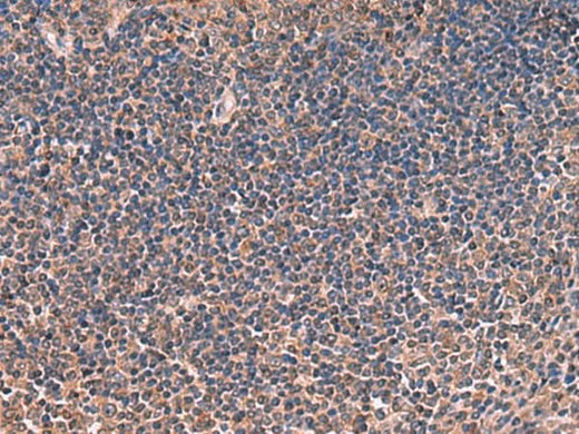 Immunohistochemistry of paraffin-embedded Human tonsil tissue using ITIH4 Polyclonal Antibody at dilution of 1:30(×200)