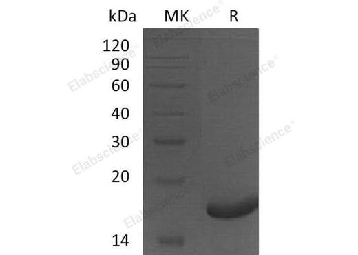 Recombinant Human Peroxiredoxin 5/PRDX5 Protein (His Tag) - ABMIUM